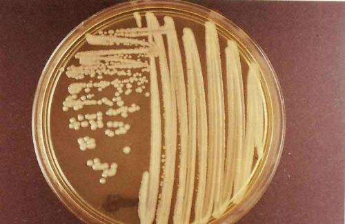 Бактерии на чашке Петри