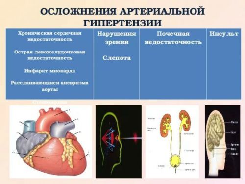 Осложнения артериальной гипертензии