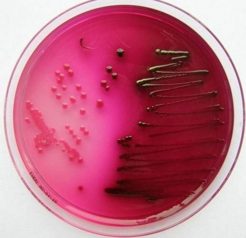 Колонии бактерий на чашке Петри
