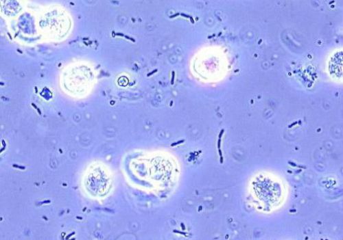 Бактерии и лейкоциты в моче