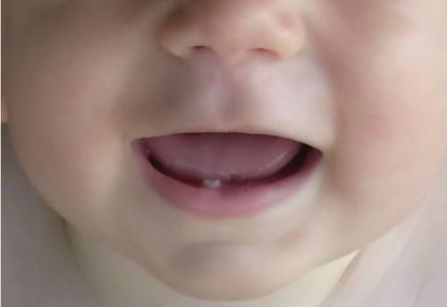Первый зуб малыша