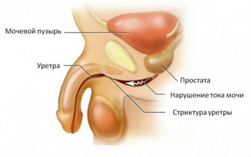 Анатомия мочевыделительной системы у мужчин