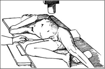 Положение пациента при проведении уретрографии