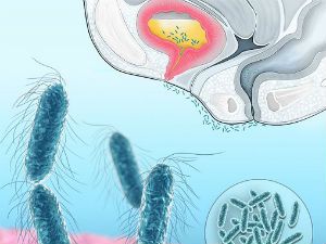 Бактерии в моче