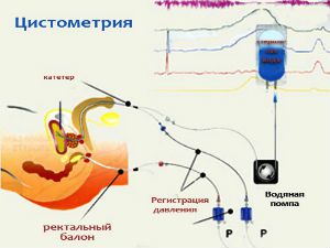 Цистометрия