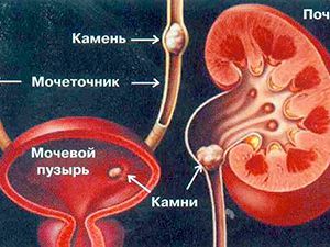 почки и другие органы мочевыделительной системы